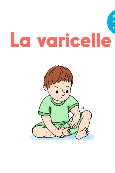 LA VARICELLE